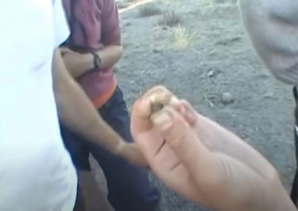 Foto - Sırtından çıkanlar görenleri şaşkına çevirdi! Sivilce zannettiği yaradan bakın ne çıktı