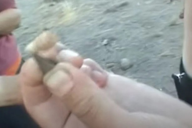 Foto - Sırtından çıkanlar görenleri şaşkına çevirdi! Sivilce zannettiği yaradan bakın ne çıktı