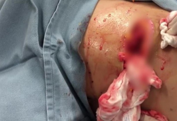 Foto - Sırtından çıkanlar hayrete düşürdü