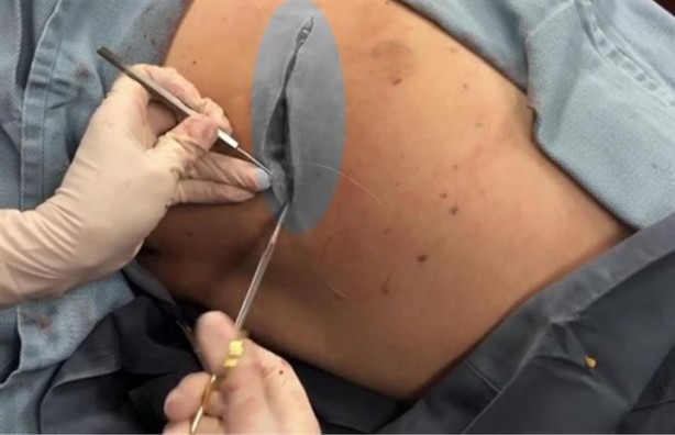 Foto - Sırtından çıkanlar hayrete düşürdü