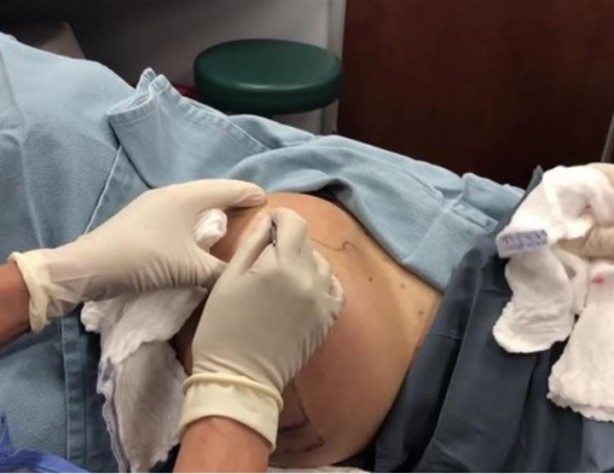 Foto - Sırtından çıkanlar hayrete düşürdü