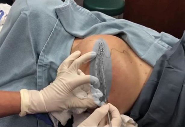 Sırtından çıkanlar hayrete düşürdü