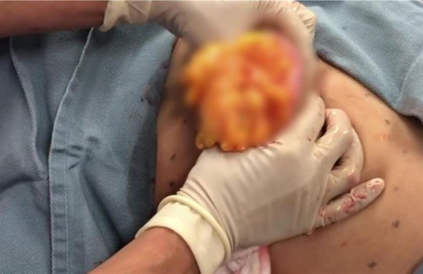 Foto - Sırtından çıkanlar hayrete düşürdü