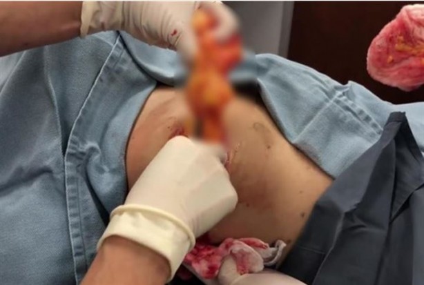 Foto - Sırtından çıkanlar hayrete düşürdü