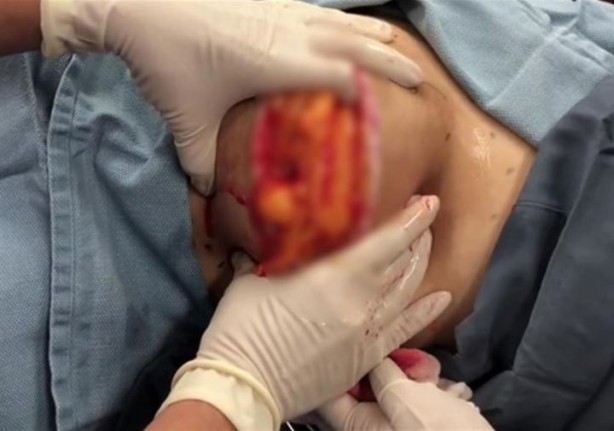 Foto - Sırtından çıkanlar hayrete düşürdü