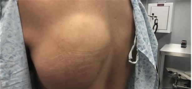 Foto - Sırtından çıkanlar hayrete düşürdü