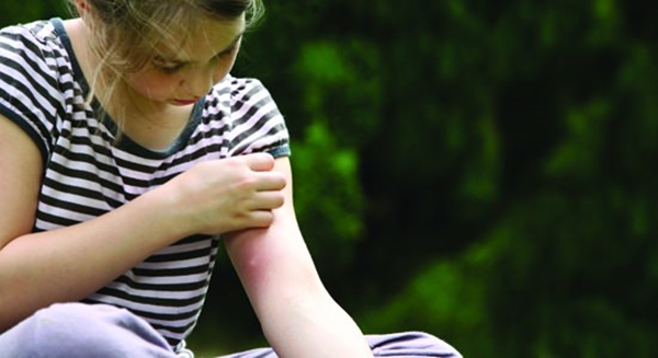 Foto - Sivrisinekler en çok kimleri ısırıyor?