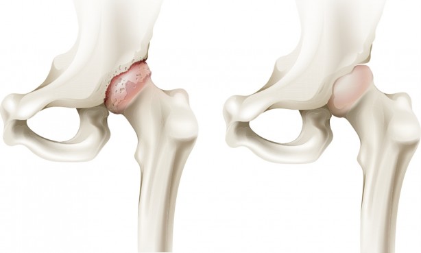 Foto - Siyah çayın bilmediğimiz faydaları...