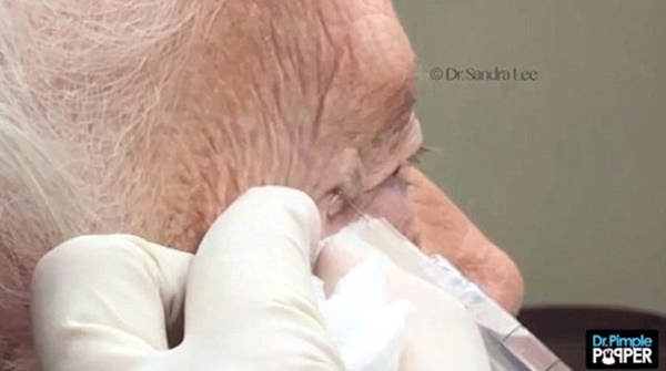 Foto - Siyah nokta sandı ama...