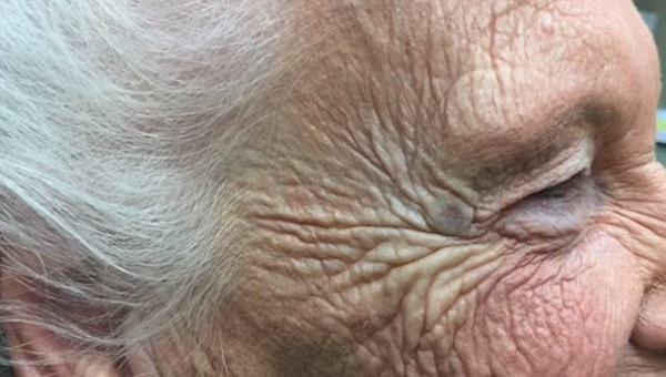 Foto - Siyah nokta sandı ama...