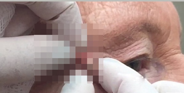 Siyah nokta sandı ama...