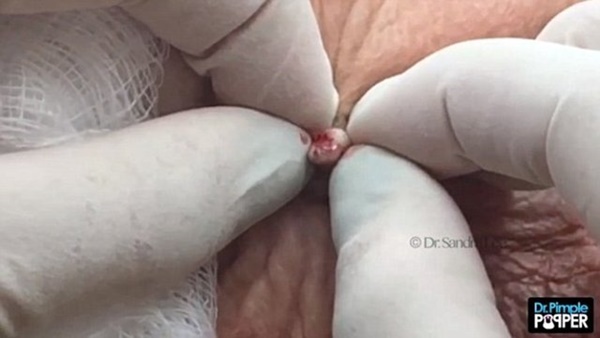 Foto - Siyah nokta sandı ama...