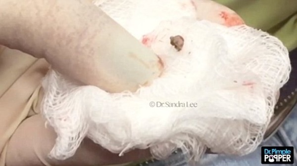 Foto - Siyah nokta sandı ama...