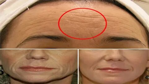 Foto - Sizde bu varsa doktora gidin! Kötü hastalığın ilk belirtisi