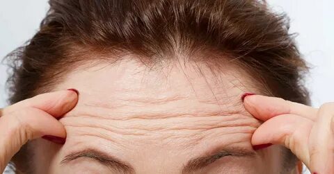 Foto - Sizde bu varsa doktora gidin! Kötü hastalığın ilk belirtisi