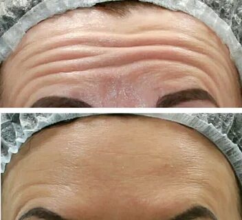 Foto - Sizde bu varsa doktora gidin! Kötü hastalığın ilk belirtisi