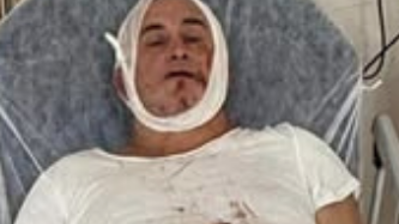 Skandala bakın... Kaş’ta maç sonrası şiddet olayı: Çenesi kırılan velinin tedavisi sürüyor