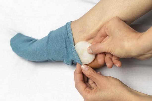 Foto - Soğanı yatmadan önce çorabınızın içine koyarsanız bakın ne oluyor! Sonucu görenler inanamıyor