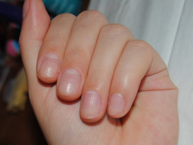 Foto - Soğuk havalarda elleri sağlıklı tutmanın yolları