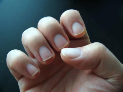 Foto - Soğuk havalarda elleri sağlıklı tutmanın yolları