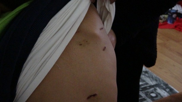 Foto - Sokak köpekleri okula giden çocuğa dehşeti yaşattı! 