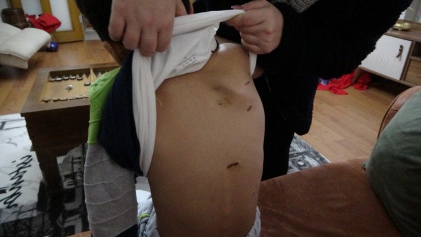 Foto - Sokak köpekleri okula giden çocuğa dehşeti yaşattı! 