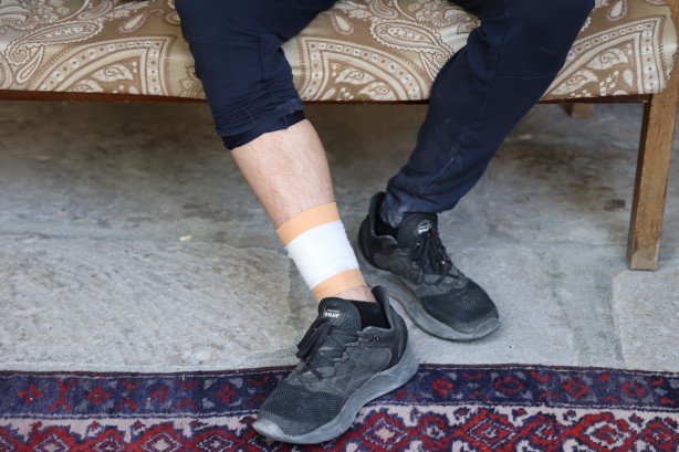 Foto - Sokak köpekleri turisti yaraladı