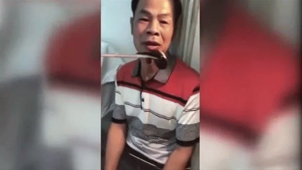 Foto - Şoke eden olay! Kanayan burnundan çıkanlar şaşkına çevirdi