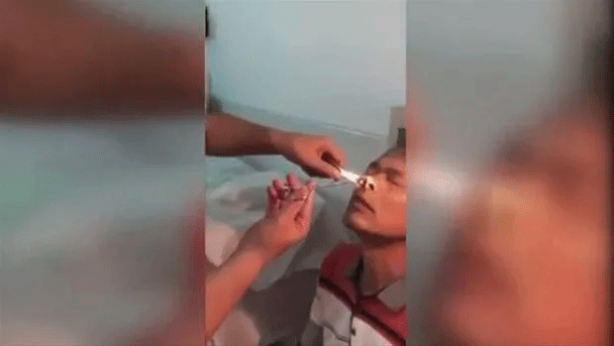 Foto - Şoke eden olay! Kanayan burnundan çıkanlar şaşkına çevirdi