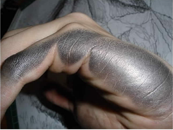 Foto - Solak insanların her gün karşılaştığı problemler