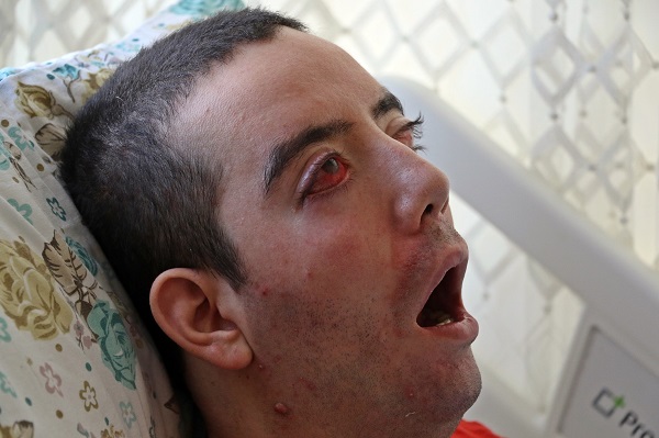 Foto - Son sözünü duyanın yüreği parçalanıyor! Tam 10 yıldır gözlerini kapatamıyor