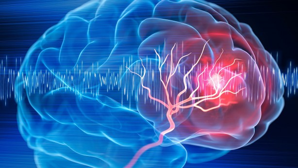 Foto - Sosyal medya bunu konuşuyor! 3 soruyu 100 kişiden 7’si çözebiliyor