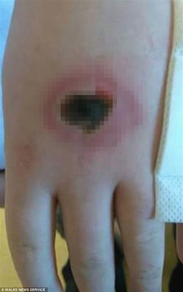 Sosyal medyada çok tehlikeli akım!