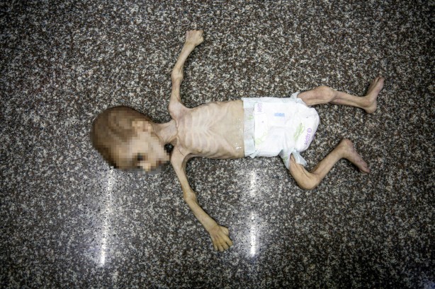 Soyun kurusun İsrail! Açlıktan ölen 7 aylık bebeğin son hali yürekleri dağladı