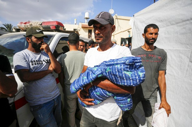 Foto - Soyun kurusun İsrail! Açlıktan ölen 7 aylık bebeğin son hali yürekleri dağladı