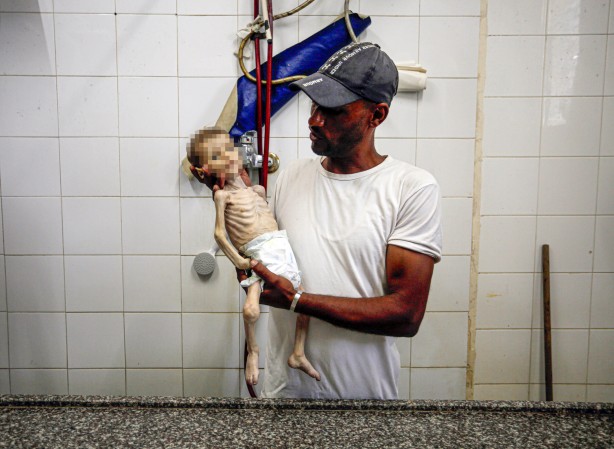 Foto - Soyun kurusun İsrail! Açlıktan ölen 7 aylık bebeğin son hali yürekleri dağladı