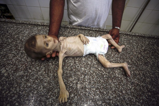 Foto - Soyun kurusun İsrail! Açlıktan ölen 7 aylık bebeğin son hali yürekleri dağladı