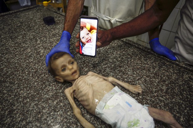 Foto - Soyun kurusun İsrail! Açlıktan ölen 7 aylık bebeğin son hali yürekleri dağladı