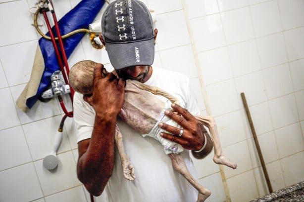 Foto - Soyun kurusun İsrail! Açlıktan ölen 7 aylık bebeğin son hali yürekleri dağladı