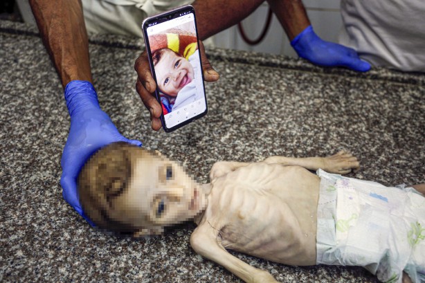 Foto - Soyun kurusun İsrail! Açlıktan ölen 7 aylık bebeğin son hali yürekleri dağladı