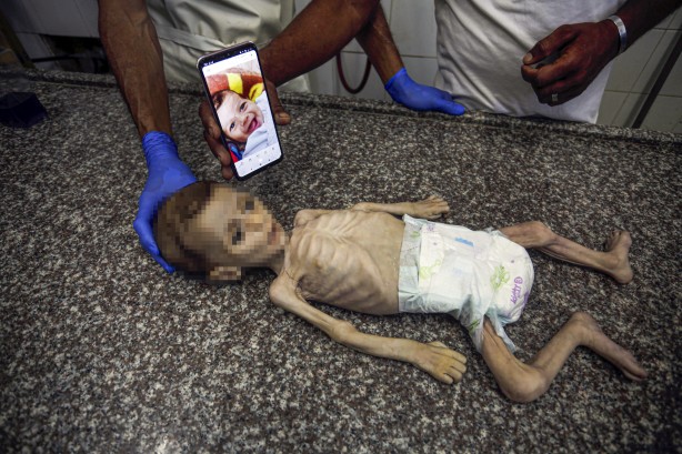 Foto - Soyun kurusun İsrail! Açlıktan ölen 7 aylık bebeğin son hali yürekleri dağladı