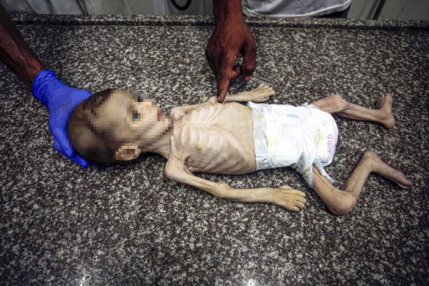 Foto - Soyun kurusun İsrail! Açlıktan ölen 7 aylık bebeğin son hali yürekleri dağladı