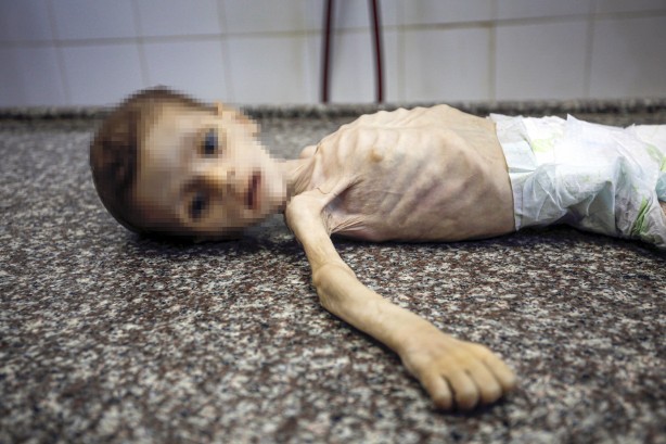 Foto - Soyun kurusun İsrail! Açlıktan ölen 7 aylık bebeğin son hali yürekleri dağladı