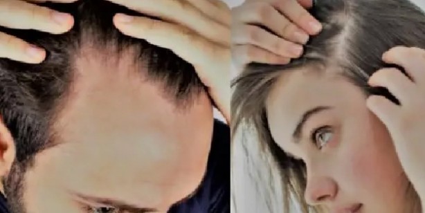 Foto - Stres altında olduğunuzun 6 işareti