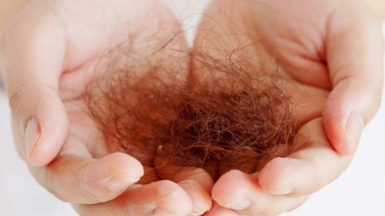 Stres kaynaklı saç dökülmesine bu çay ile dur de! Süper bir içecek! Saç dökülmesine basit çözümler!