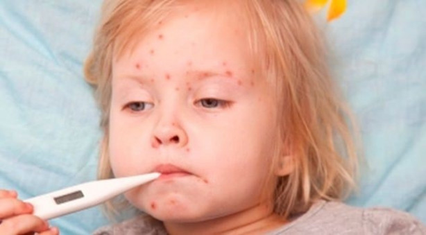 Foto - Su çiçeği sonrası o sendroma dikkat!