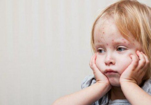 Foto - Su çiçeği sonrası o sendroma dikkat!