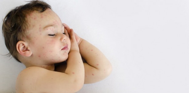 Foto - Su çiçeği sonrası o sendroma dikkat!