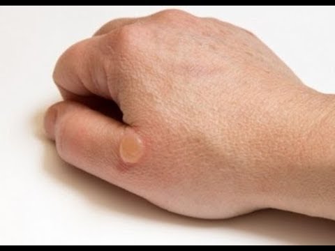 Foto - Su toplayan bir yeri neden patlamamamız gerektiğini öğrenince bir daha...