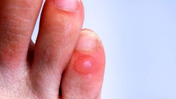 Foto - Su toplayan bir yeri neden patlamamamız gerektiğini öğrenince bir daha...